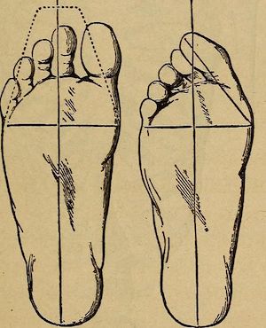 Line drawing of two left foot. One looks foot-shaped with spread toes as wide as the ball of the foot. The other has the toes squished towards a line running from the heel through the center of the ball of the foot, and is frankly deformed.